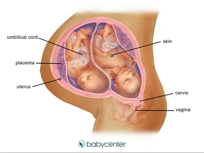 Быть беременной двойней