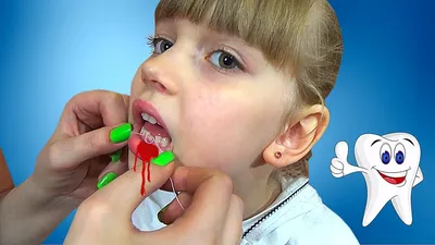 Вырвать зуб у ребенка