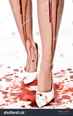 Кровь на ногах